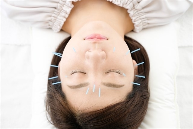 アゴの鍼